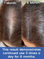 Rosemary and Rice Water Hair Growth Spray by Shya Haircare